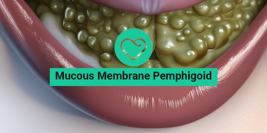 mucous membrane pemphigoid mild